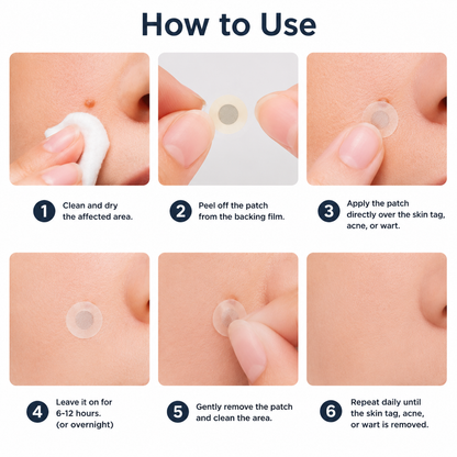 Molescarcure® 2-in-1 Microneedle & Hydrocolloid Patch🍀| Removes Raised Moles, Acne, Flat Warts & Skin Tags