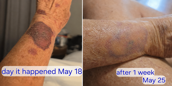 Customer review photo