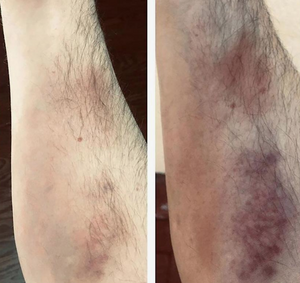 Customer review photo