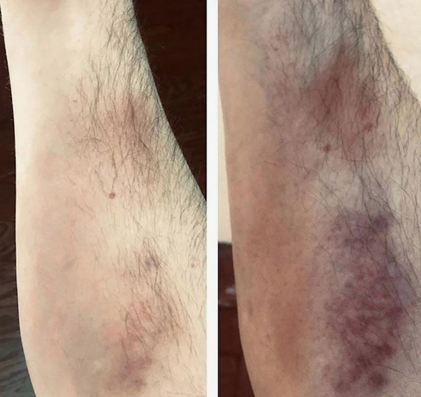 Customer review photo