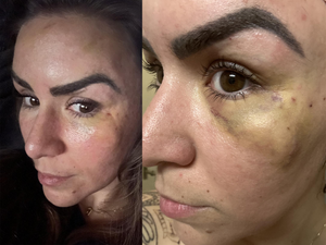 Customer review photo