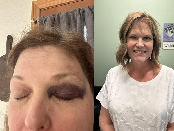 Customer review photo