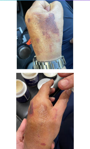 Customer review photo