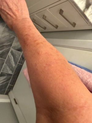 Customer review photo