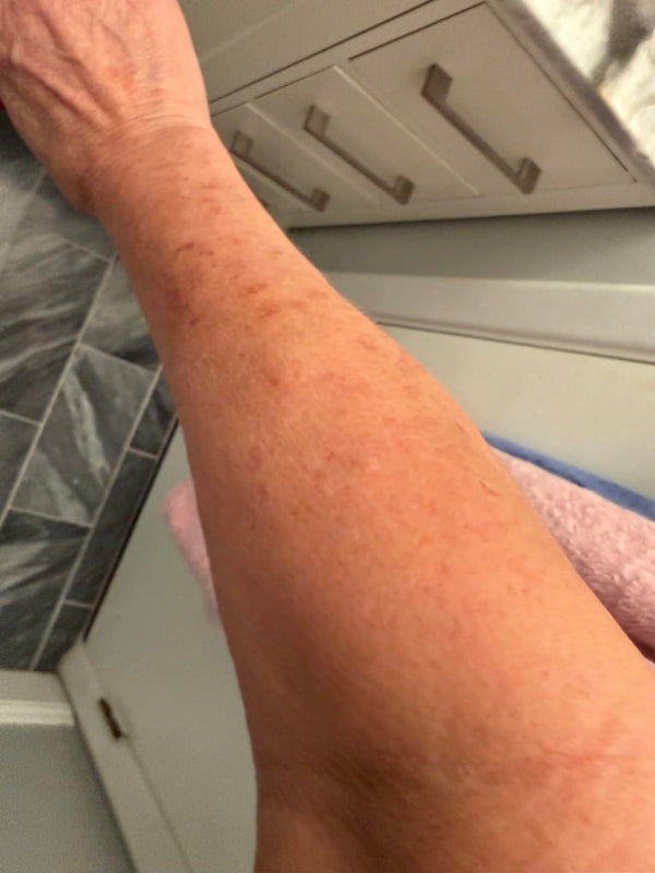 Customer review photo