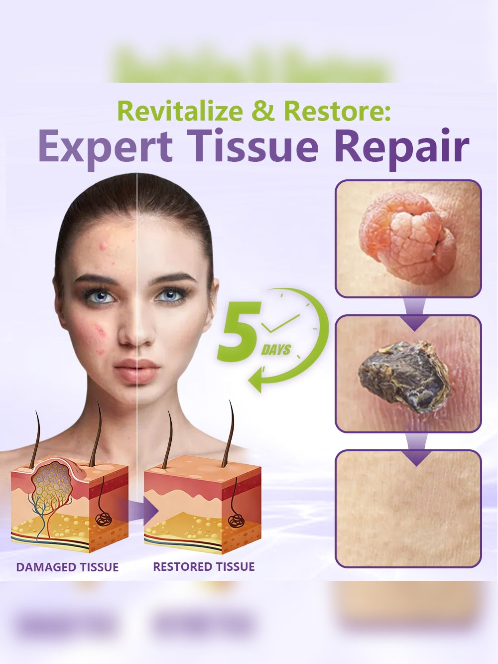 Skin tag patch illustration